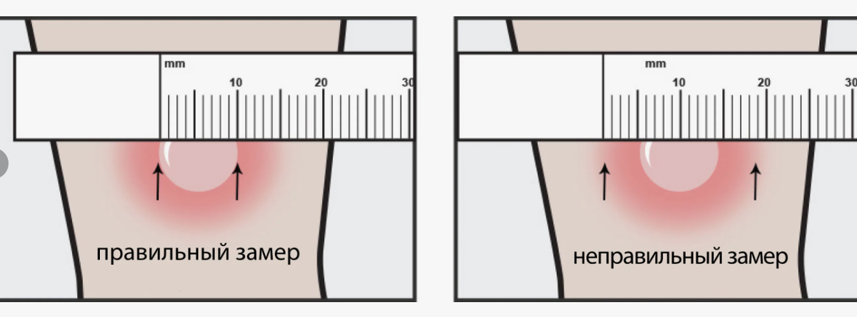 Методика измерения не учитывает покраснение вокруг