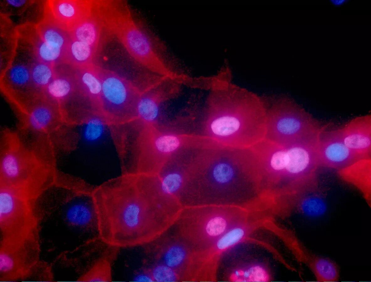    AP Photo / Ewa Krawczyk/National Cancer Institute via AP
