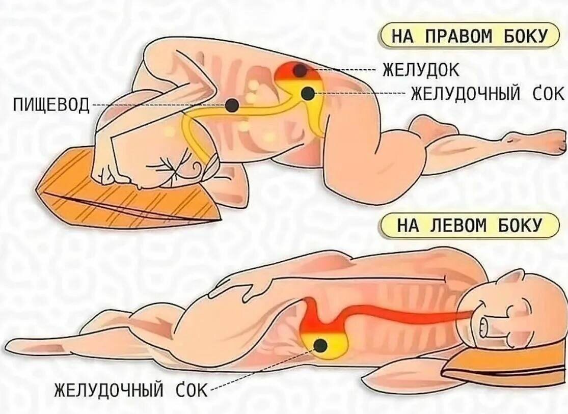 91. -4. Если правильно спать, можно избавиться от 7 болезней: от высокого д...