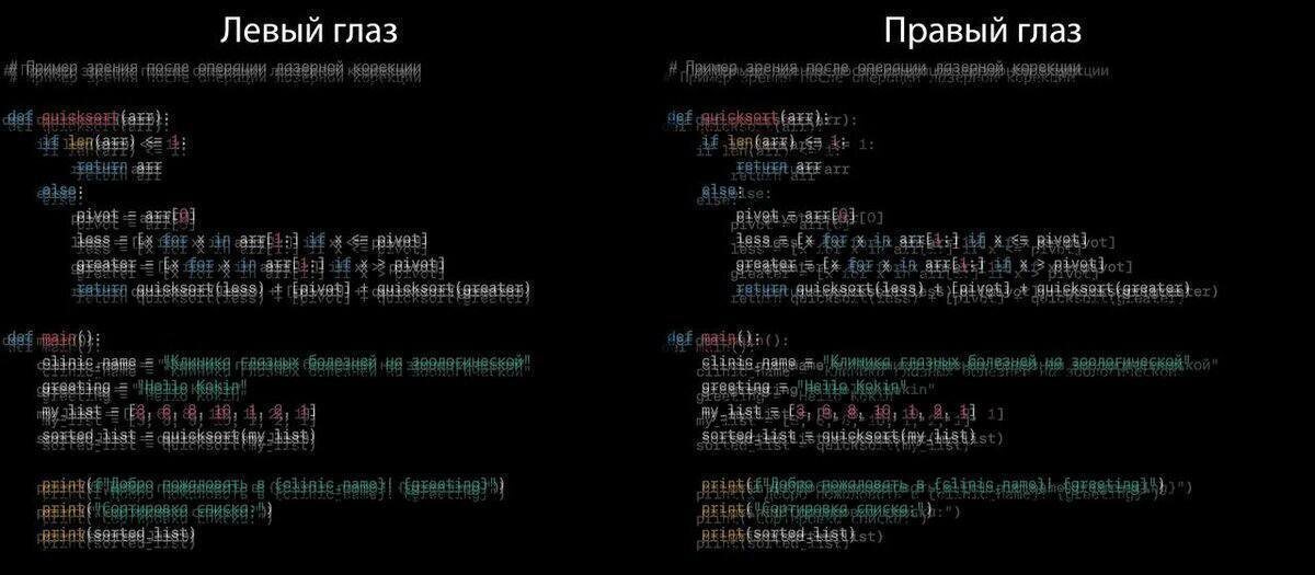 Работа за компьютером после лазерной коррекции зрения