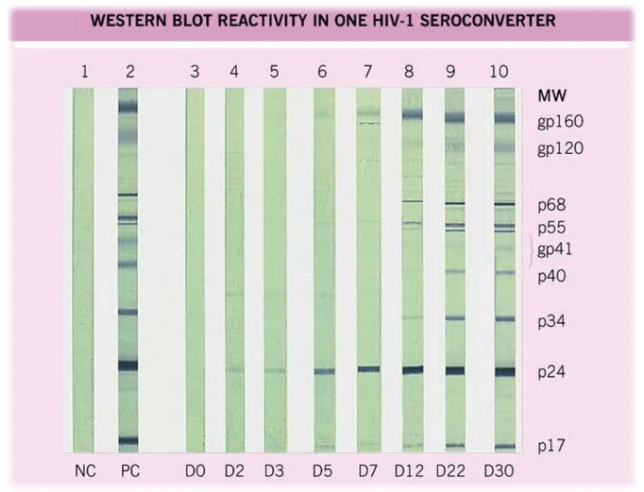 Иммуноблот. Изображение: microbeonline.com.