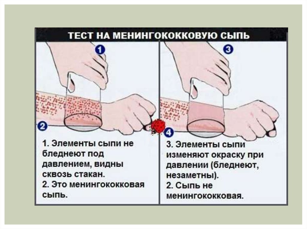 Можно ли чем то заразиться в общественном туалете