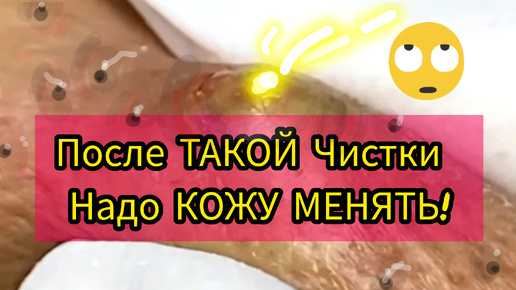 КАК Можно ТАК Убирать КАМЕДОНЫ?Тут РАботы не Початый край!