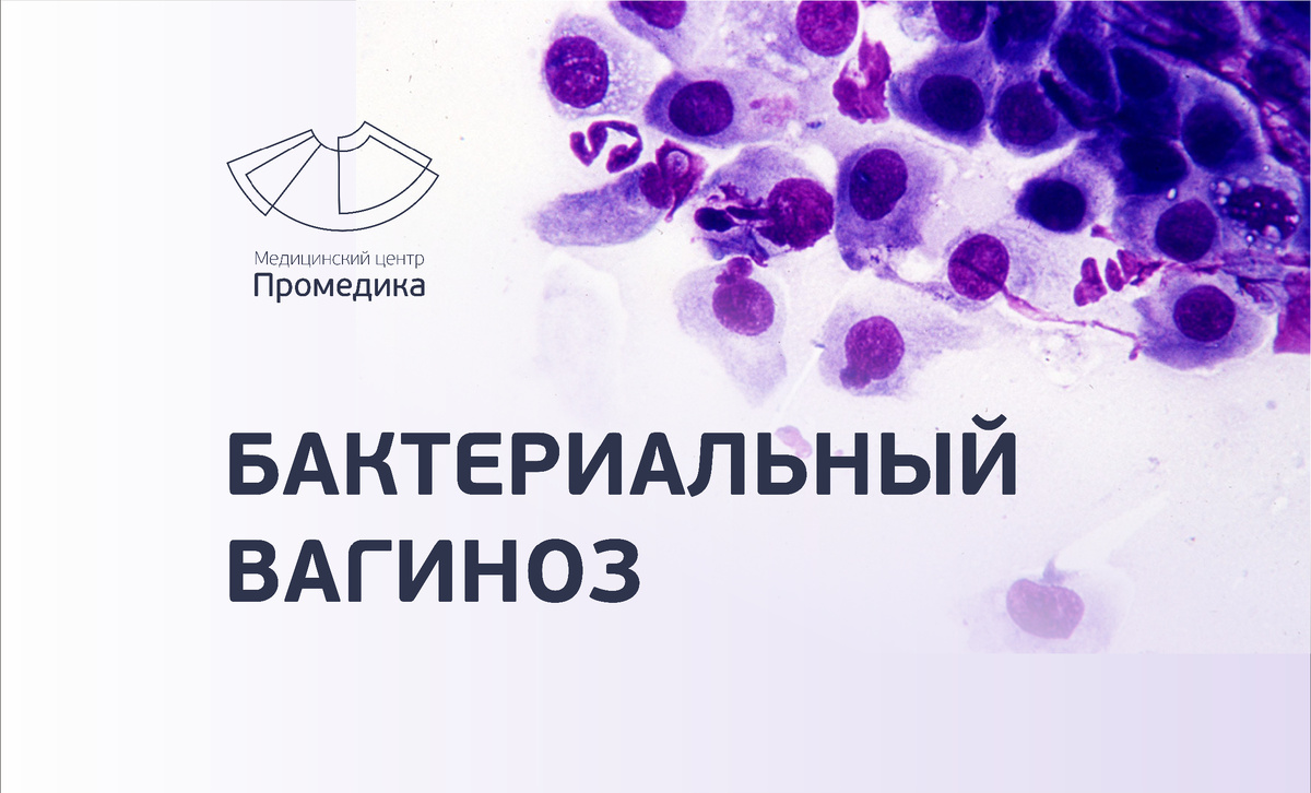 Почему не стоит игнорировать симптомы бактериального вагиноза? 