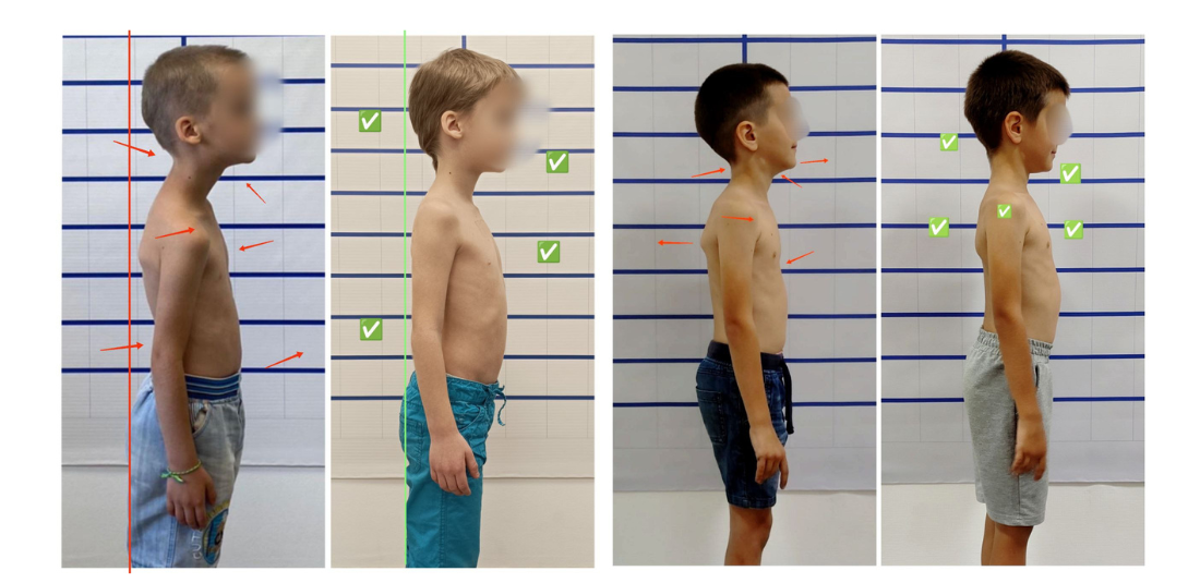 Фото ДО и ПОСЛЕ восстановительной программы Атлант