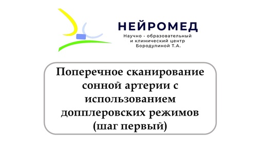 Поперечное сканирование сонной артерии с использованием допплеровских режимов