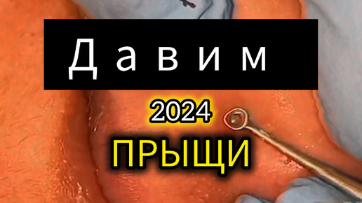 ДавитЬ НельзЯ ОставитЬ. Запятую поставьте сами.ПРЫЩИ.