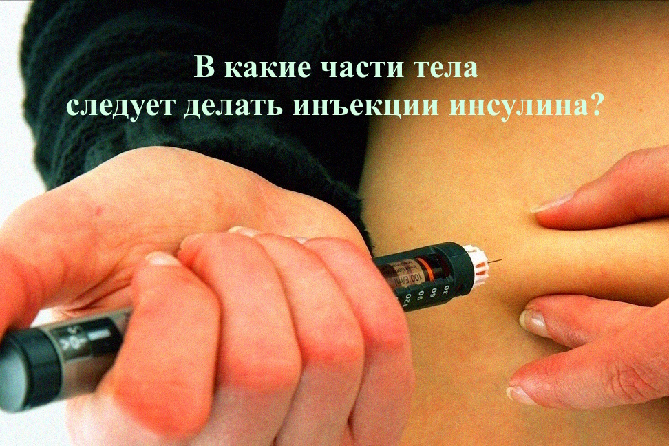 Яндекс.Картинки