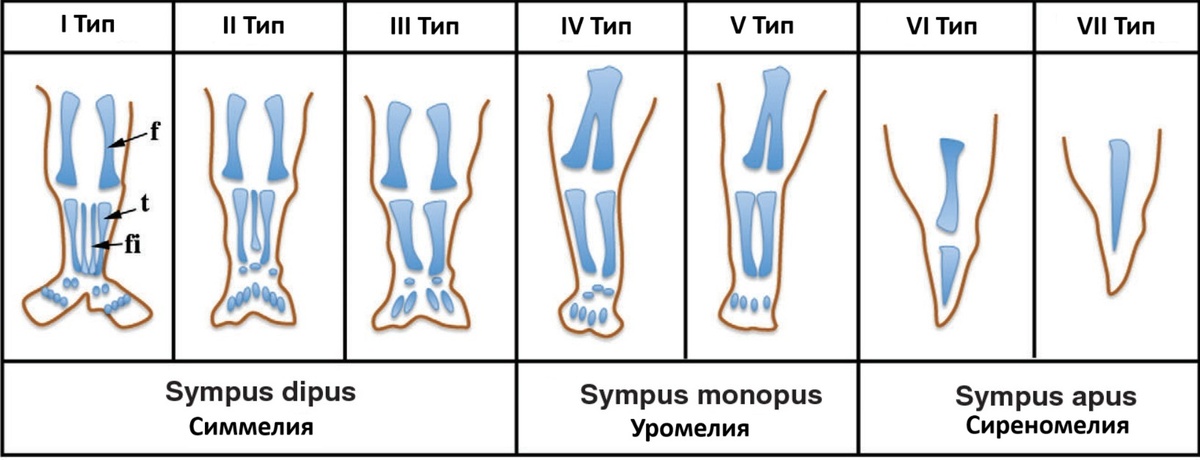 Схема 7 типов синдрома