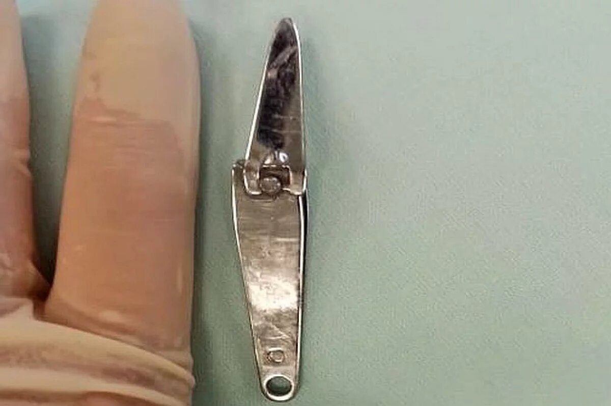    В Уфе врачи достали из желудка 6-летнего мальчика щипцы для стрижки ногтей