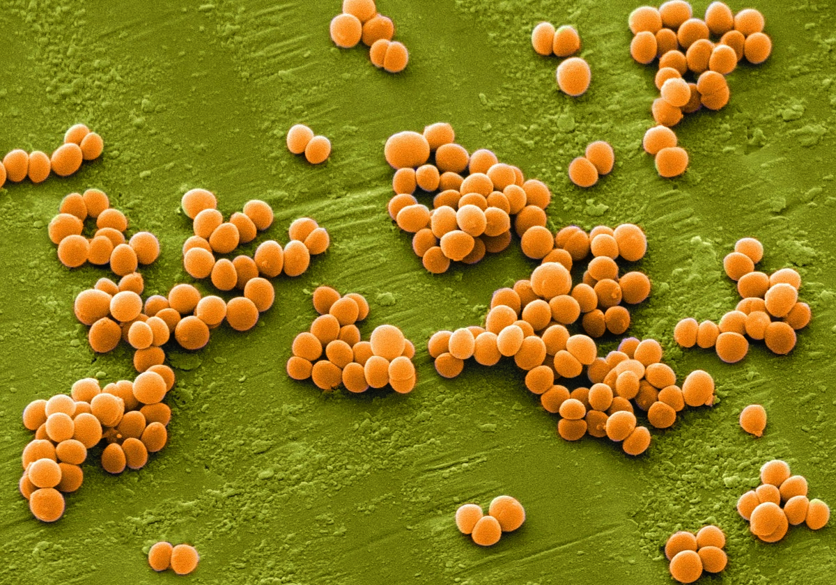 Бактерия Staphylococcus aureus
