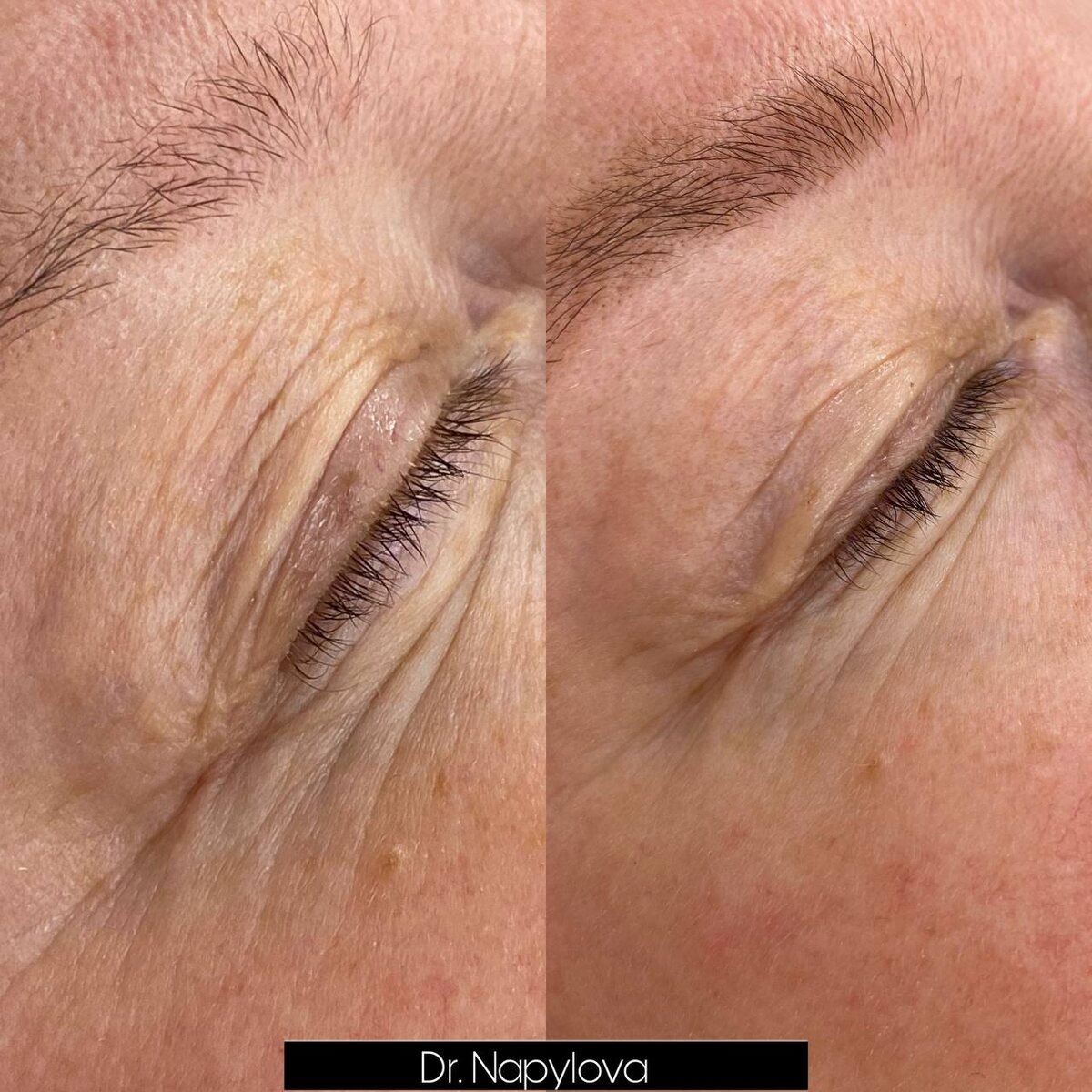 Врач-косметолог Напылова Мария Николаевна 