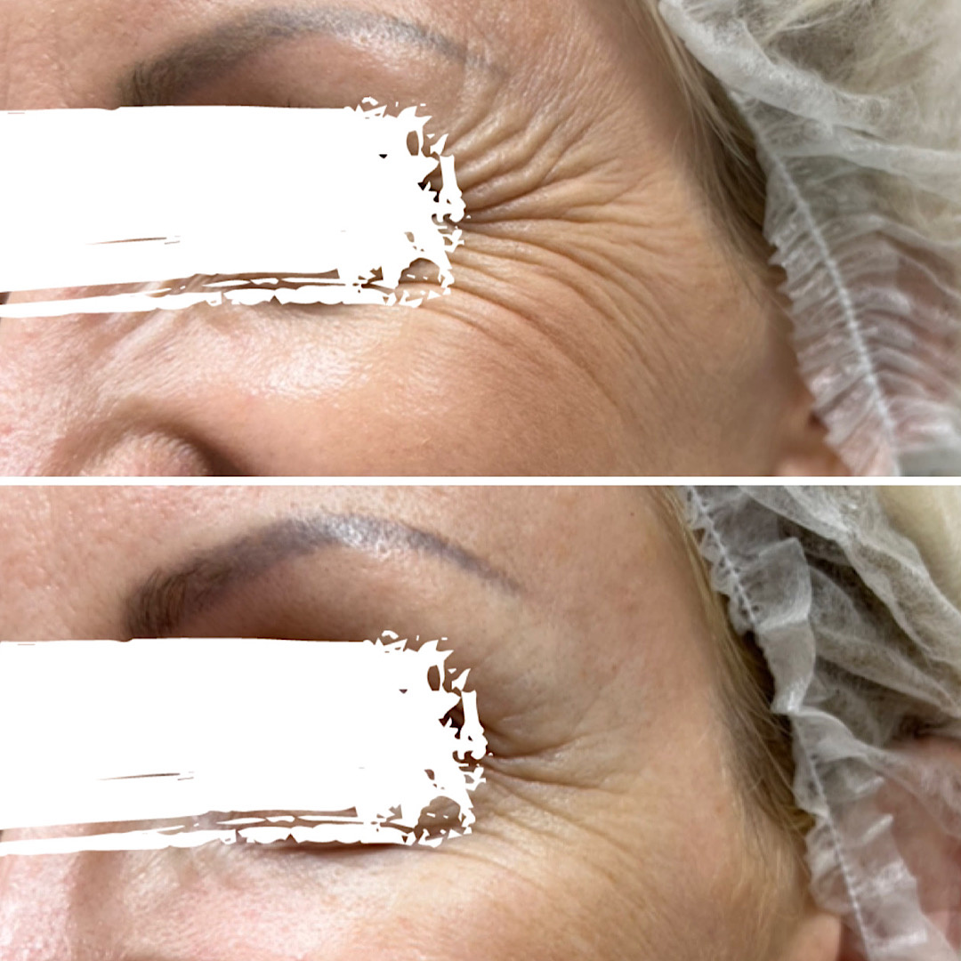 Врач-косметолог Белых Наталья Александровна 