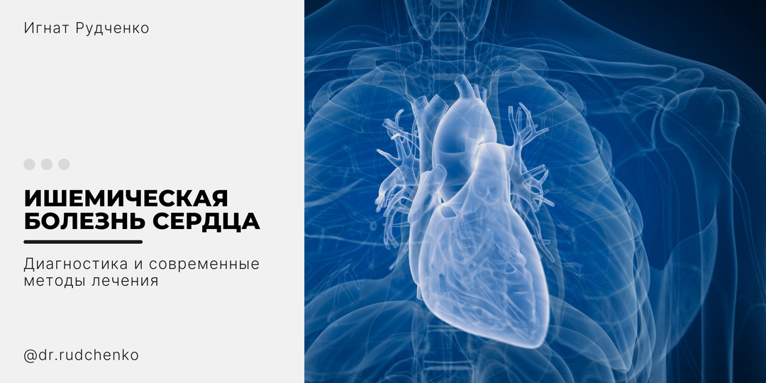 Ишемическая болезнь сердца: диагностика и современные методы лечения. Обзор методов диагностики и подходов к лечению ИБС