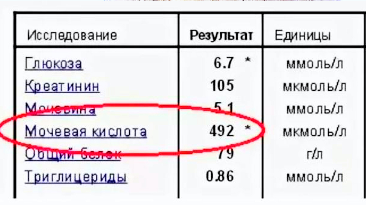 Высокий уровень мочевой кислоты?