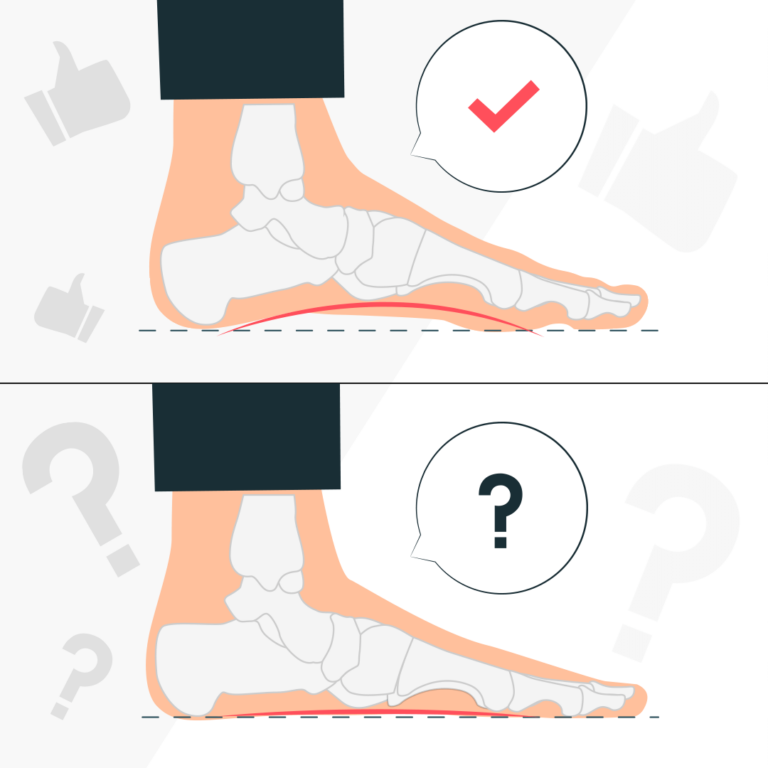 Кейс с плоскостопием