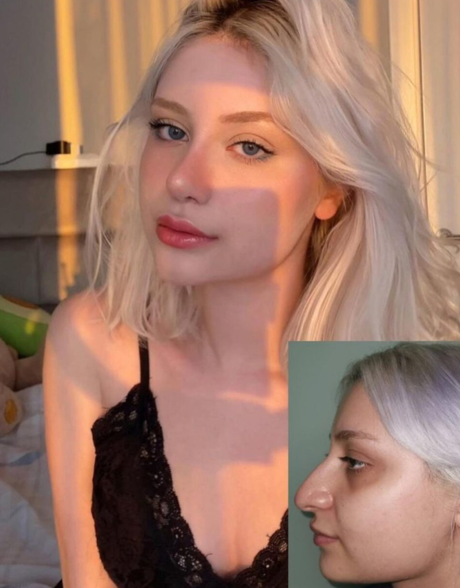 -3