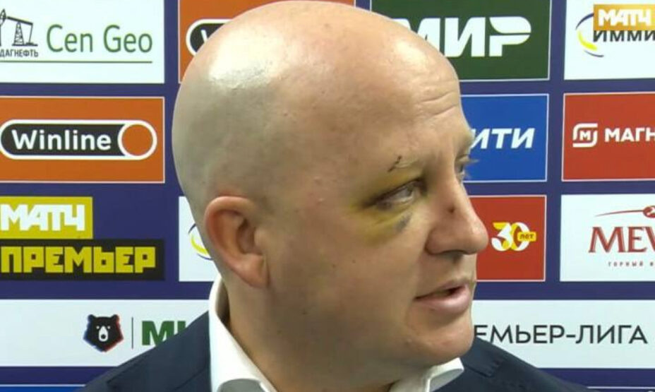    Синяк Марко Николича — самый яркий момент матча «Динамо» — Мх — ЦСКА. Фото: кадр трансляции Матч Премьер