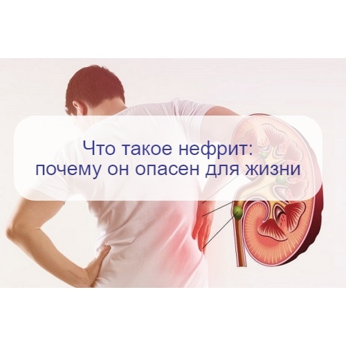 Если вовремя не вылечить, это заболевание будет медленно «убивать» ваши почки, пока они не откажут