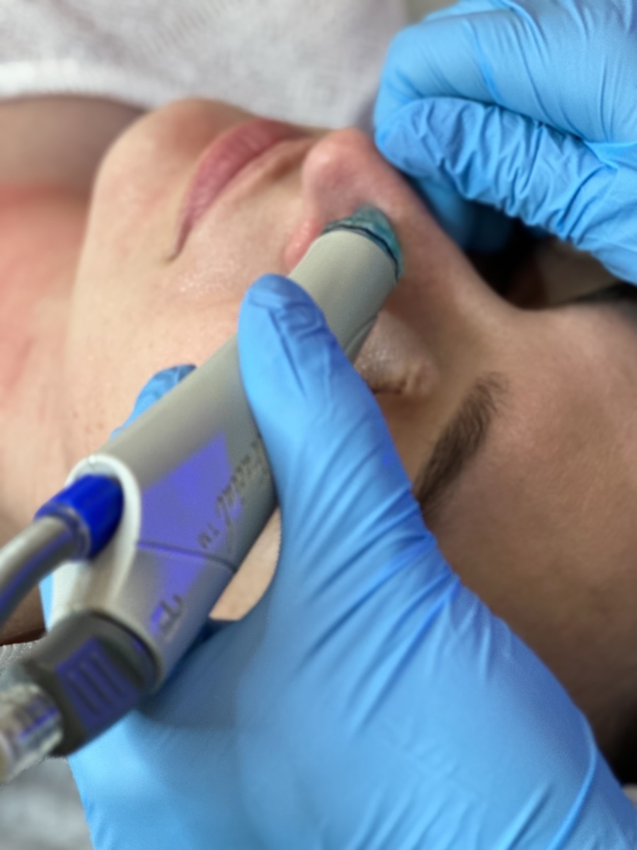 Хайдра Фешел — это инновационная процедура, которая обеспечивает глубокое очищение кожи, увлажнение и питание.