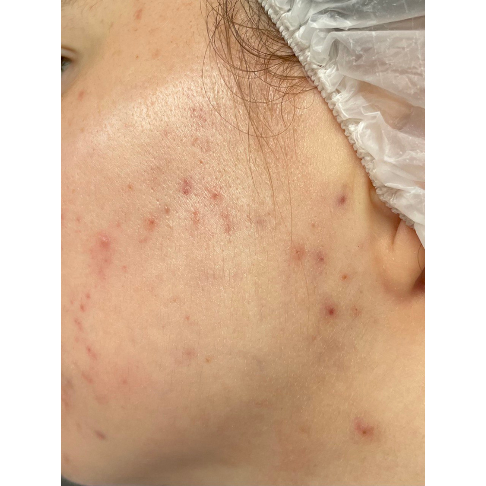 24 сентября ( первое фото до применения)