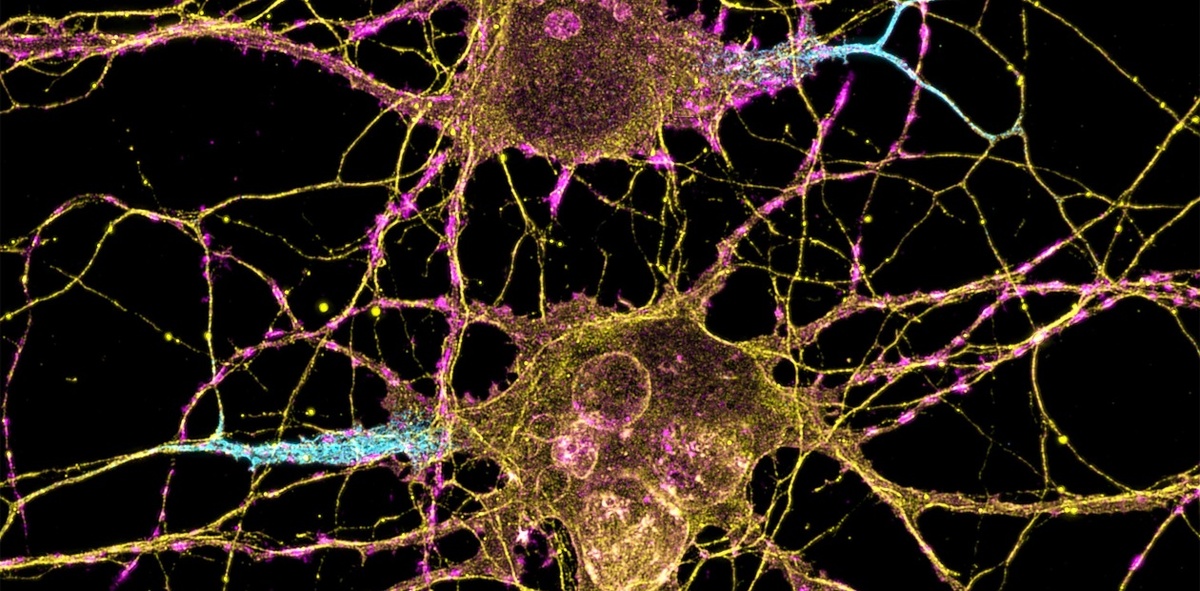 Нейроны. © CC BY-NC 2.0/Leterrier, NeuroCyto Lab, INP, Marseille, France