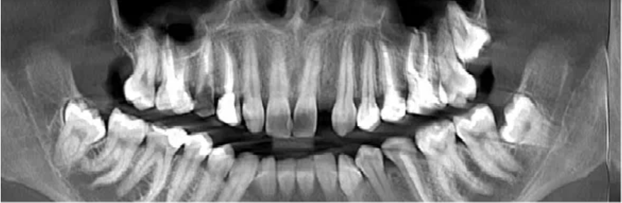 КТ Анастасии 