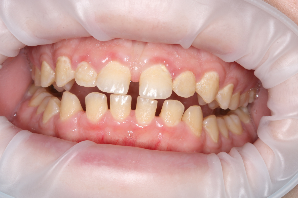 Здесь перед посещением терапевта была проведена профчистка