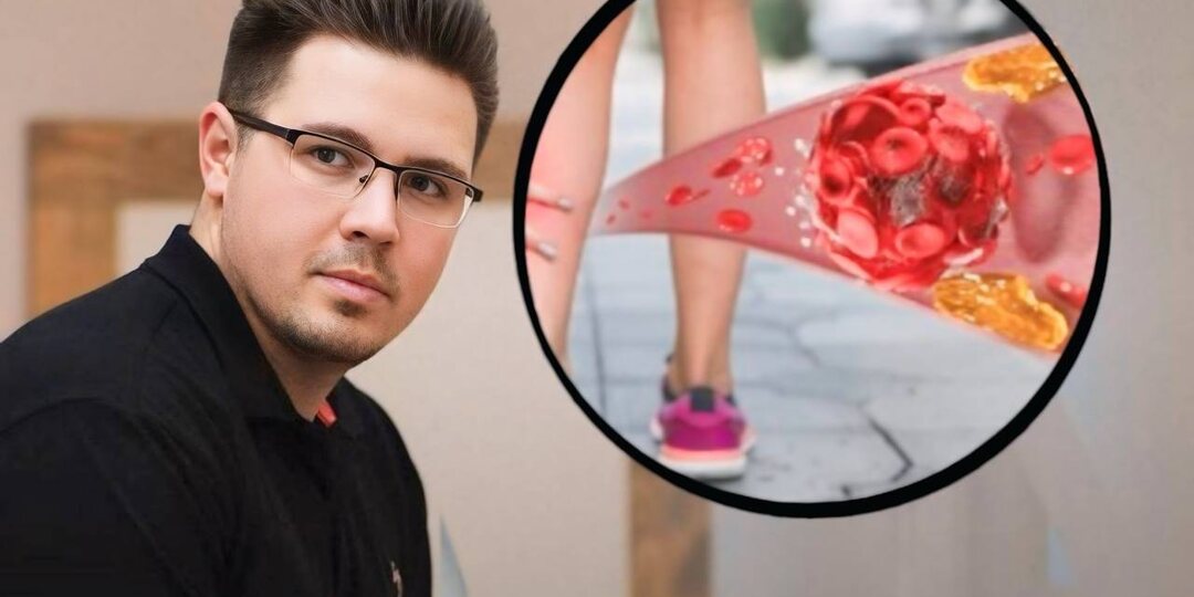 Атеросклероз ног: 3 признака, которые нельзя игнорировать