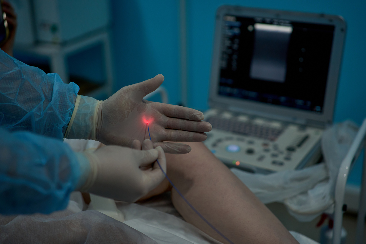 Процедура лазерного лечения занимает не более часа под местной анестезией, пациент не чувствует боли и дискомфорта. 