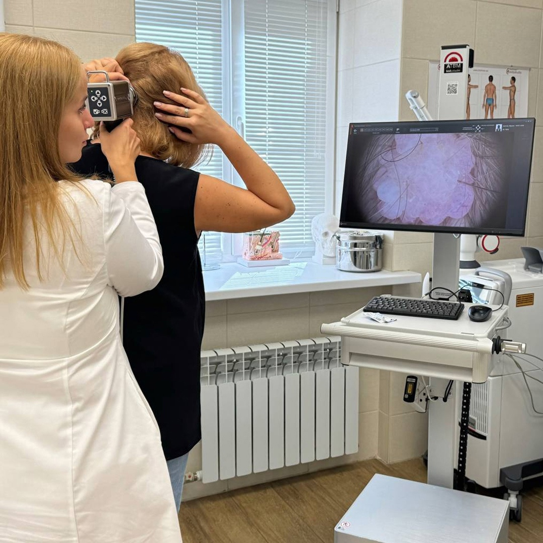 Диагностика и удаление родинок в Курске, а также других новообразований