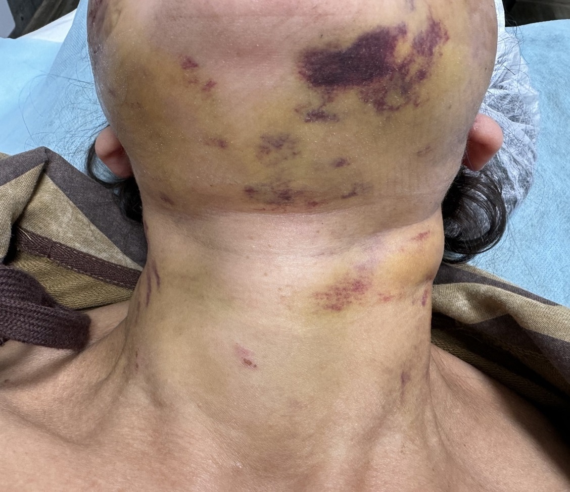 Через 7 дней