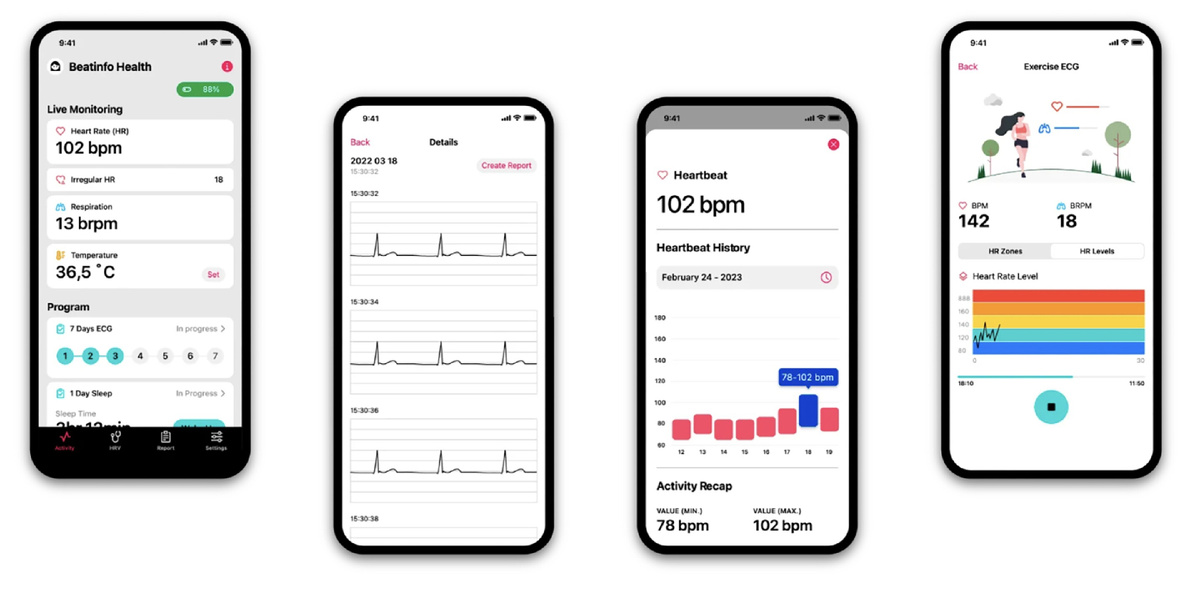 Приложение Health от Singular Wings получает данные от CGM в режиме реального времени