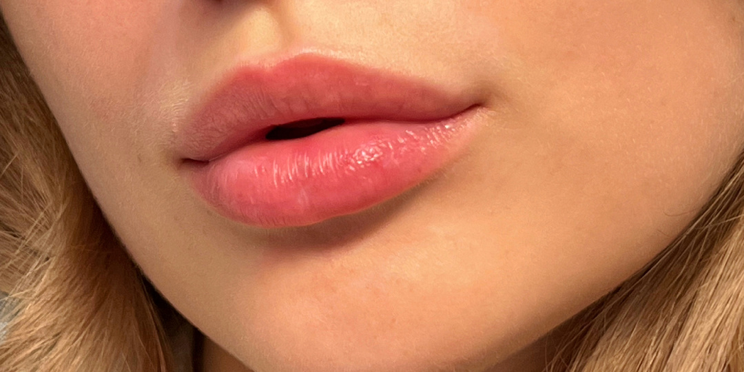 Мой любимый лайфхак в уходе за губами 👄 Скажем сухости и трещинам «НЕТ!»