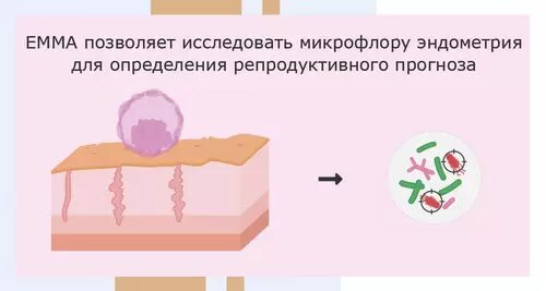 EMMA - исследование микрофлоры эндометрия
