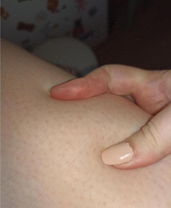 Никакой апельсиновой корки!