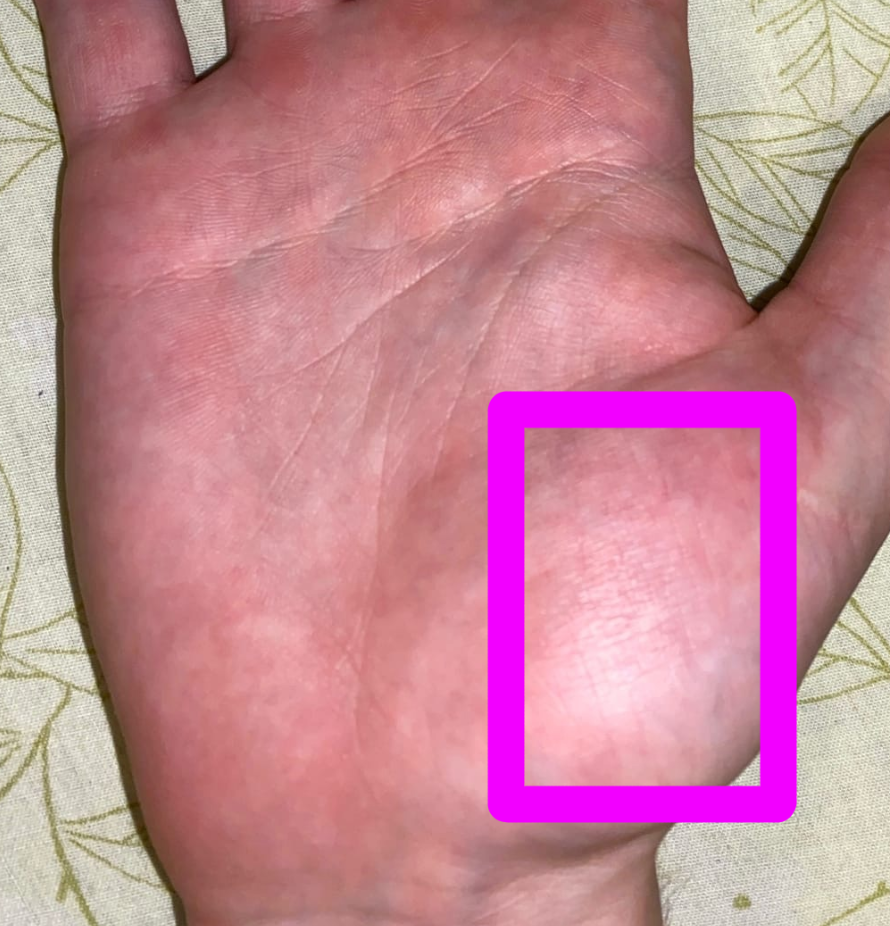 Крупный холм Венеры