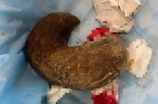    Фото: Министерство здравоохранения Новосибирской области