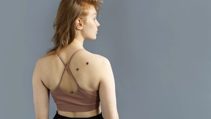     Девушка с родинками Freepic