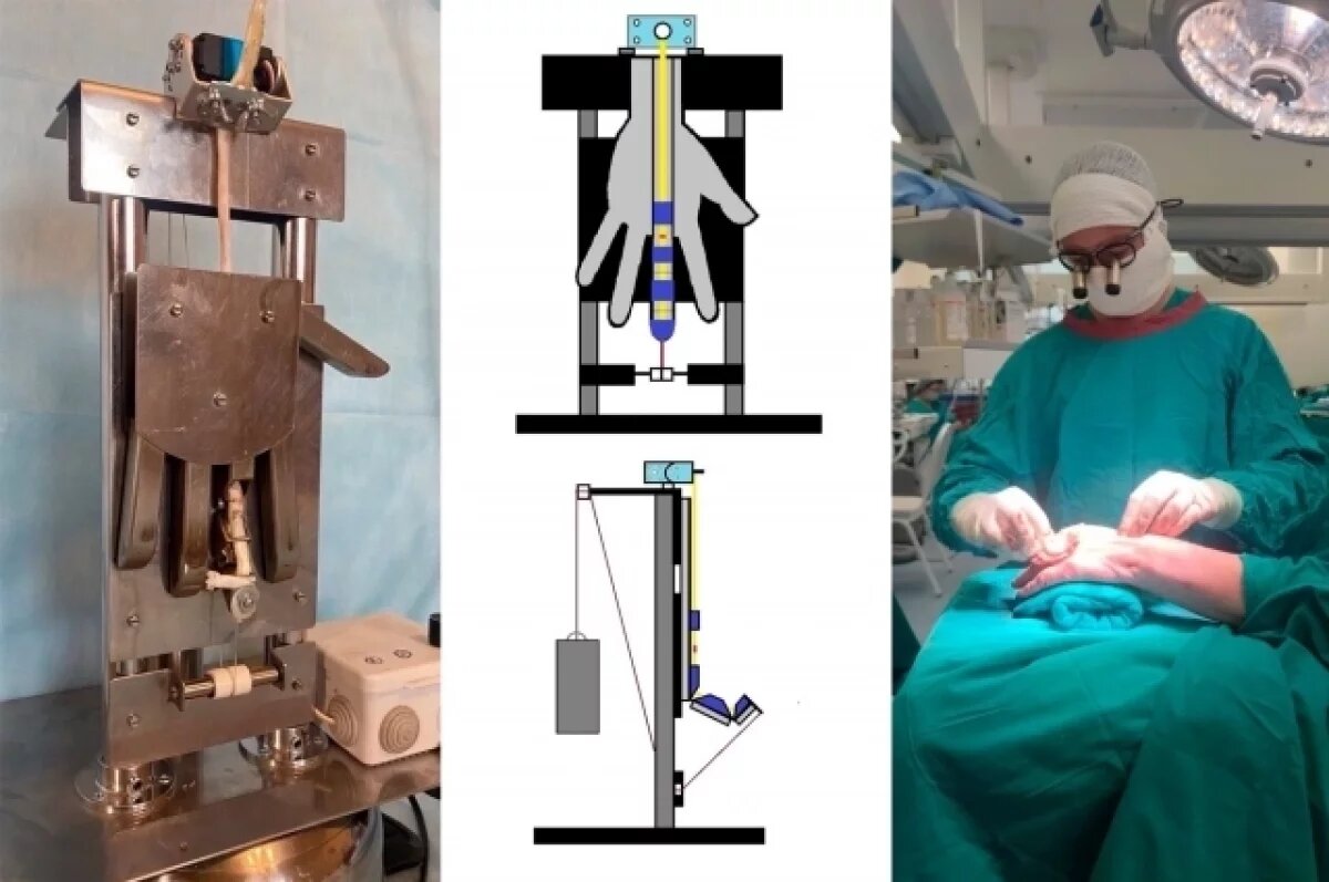    Кистевая хирургия – редкая специальность.