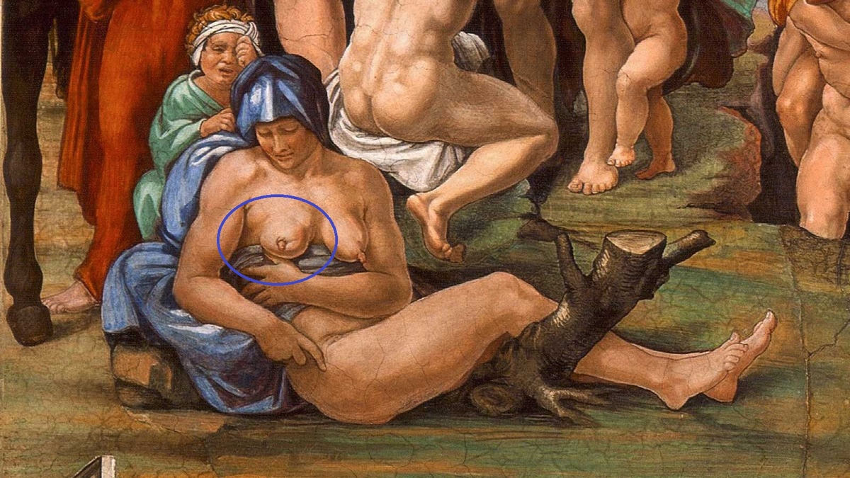 Genesis flood narrative / Public Domain / Wikipedia📷На правой груди сосок втянут и деформирован, также втянута кожа на ареоле и вокруг него, в верхнем медиальном квадранте груди заметны выпуклости, напоминающие увеличенные лимфоузлы