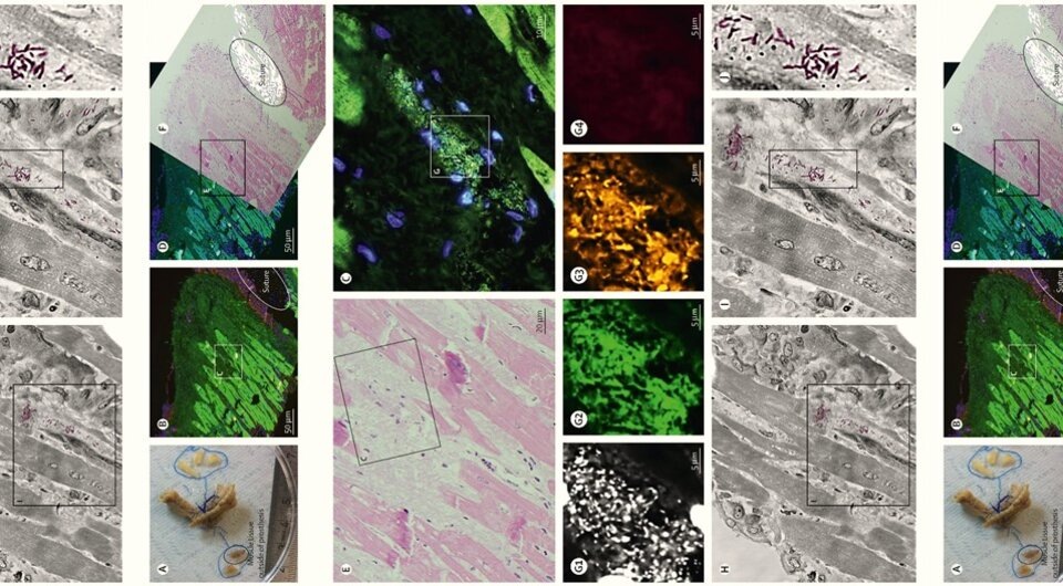   Annette Moter et al. / The Lancet Microbe, 2024