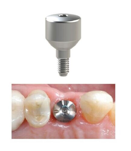 Формирователь общий вид и вид в установленном имплантате
