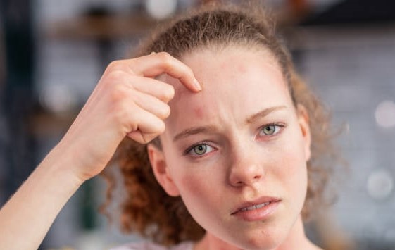 к чему чешется лоб