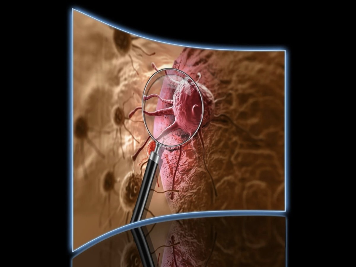    Учёные разработали ИИ-модель, способную диагностировать рак с точностью до 94%