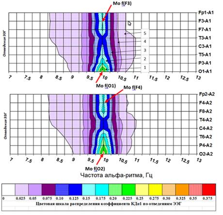 Рис.2 Дисперсионная картограмма аРЭЭГ в норме