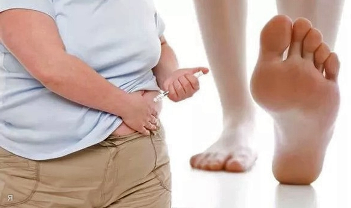 Диабет и здоровые ноги: миссия выполнима! 🦶 Спасти и сохранить - полное руководство по уходу за стопами