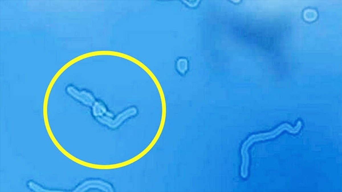 Muscae volitantes, «парящие мухи»