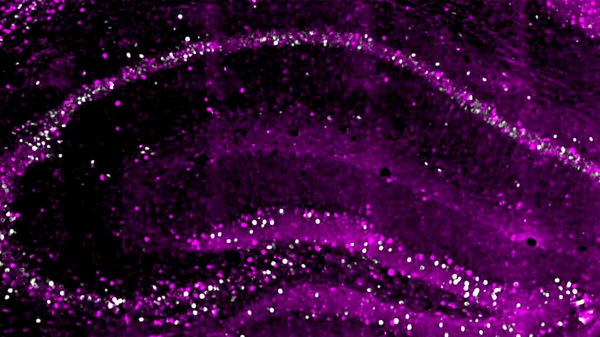 Нейроны в гиппокампе мыши