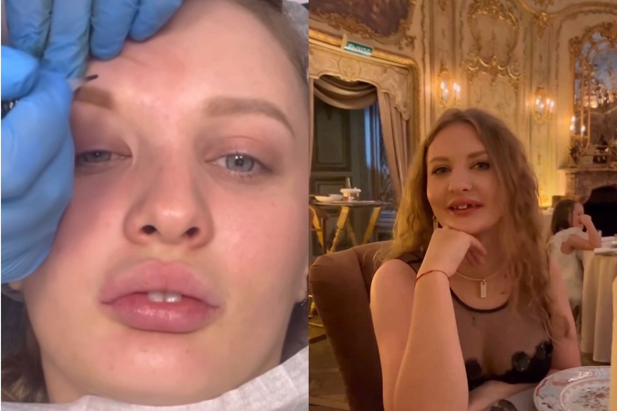 Мелисса Валынкина приехала в Москву, чтобы заработать на коррекцию челюсти. В столице и встретилась с Архипом Глушко. Фото: социальные сети.